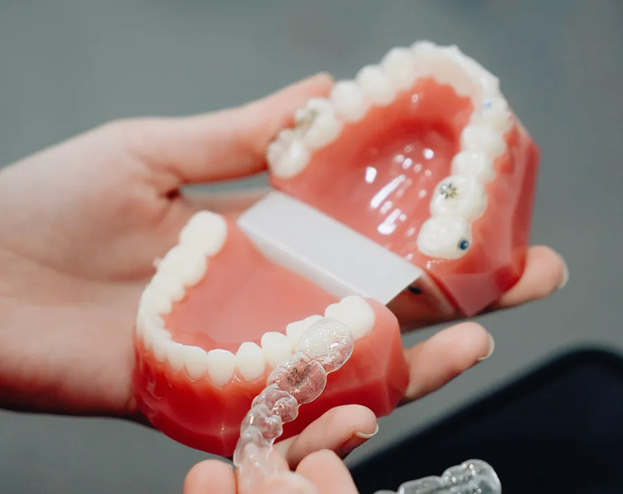 Alinhador transparente sendo retirado de um modelo odontológico
